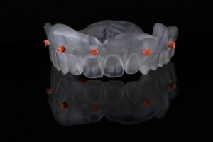 digital impression of the upper jaw 3d printing
