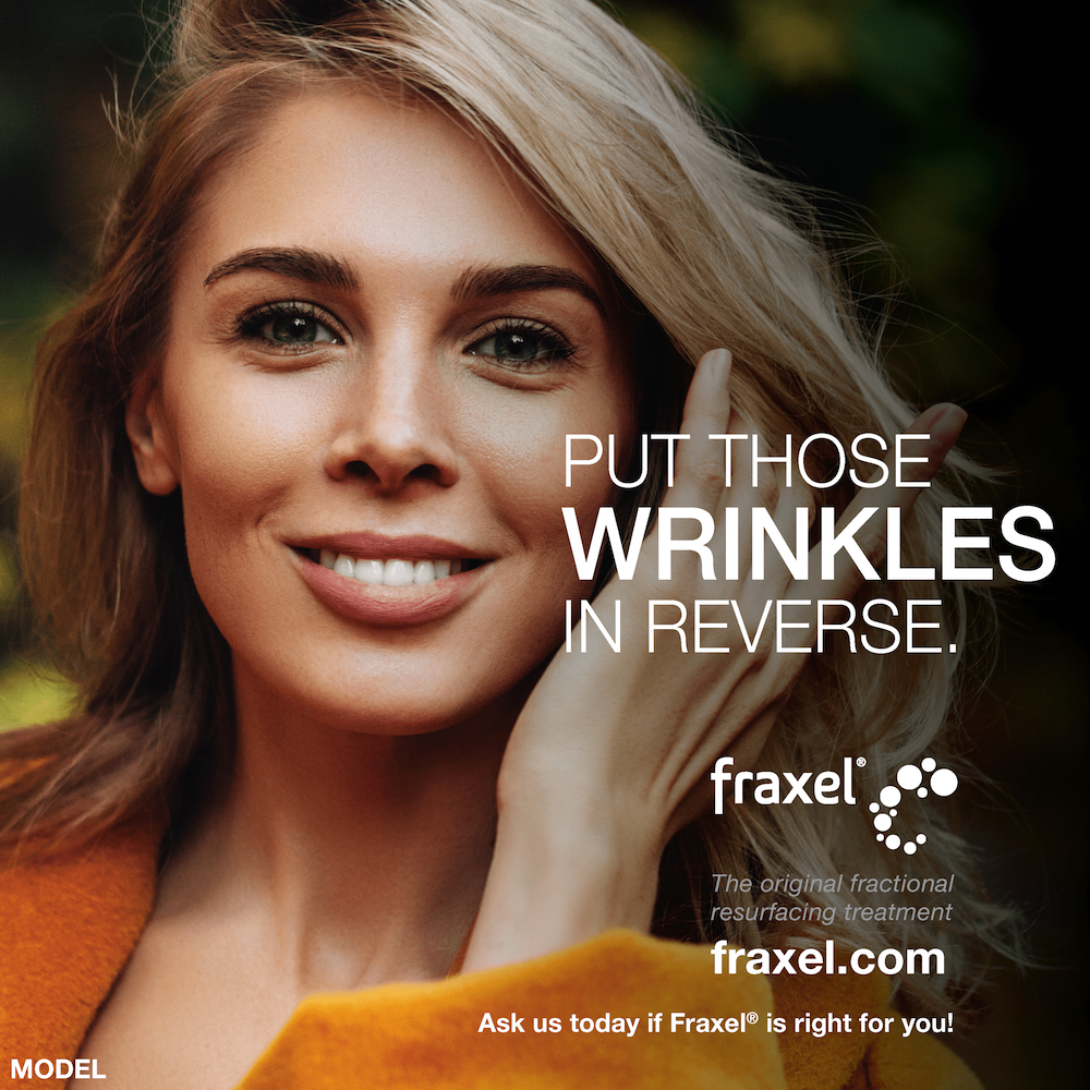 Fraxel laser Treatment for wrinkles