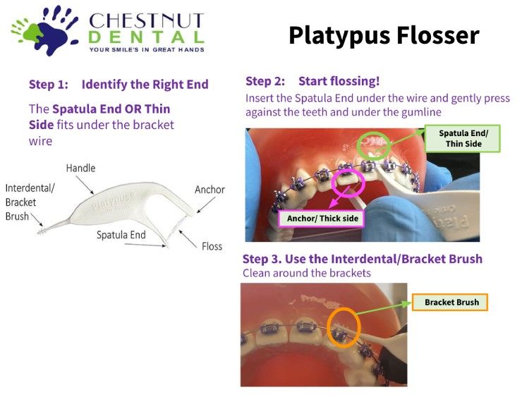 how to floss your braces pdf 1