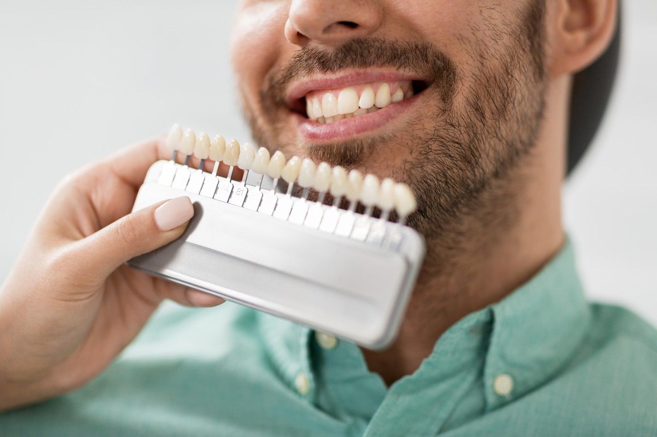 What is a Dental Impression?  Needham, Bedford, Franklin, MA