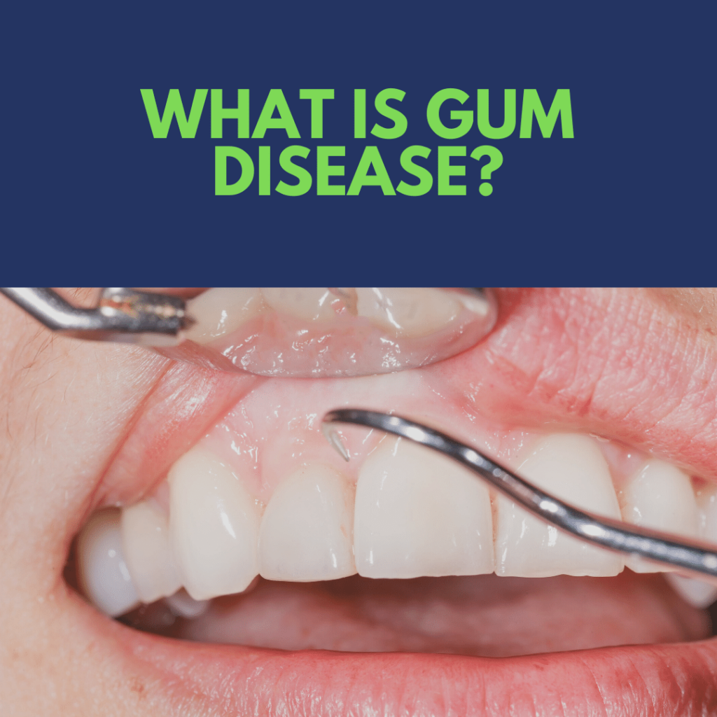 What is gum disease