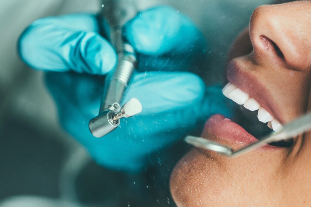 close up of mouth with dental tools and hand