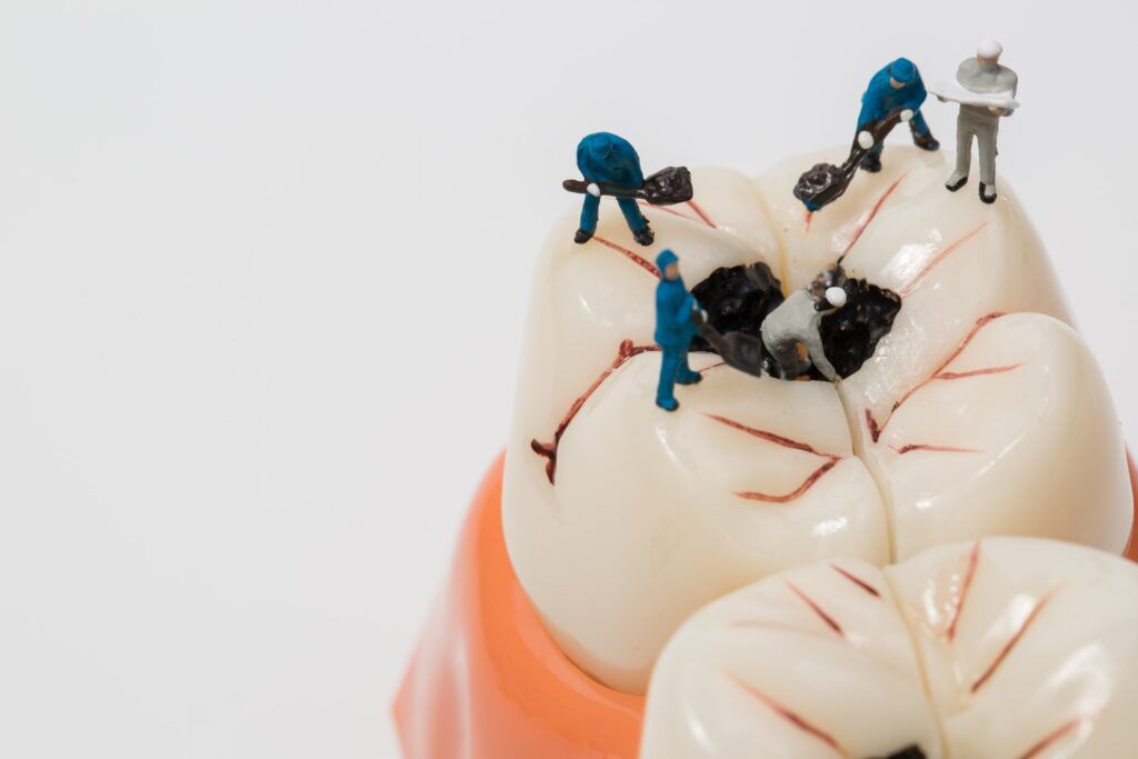 tiny people working on a hole in a tooth