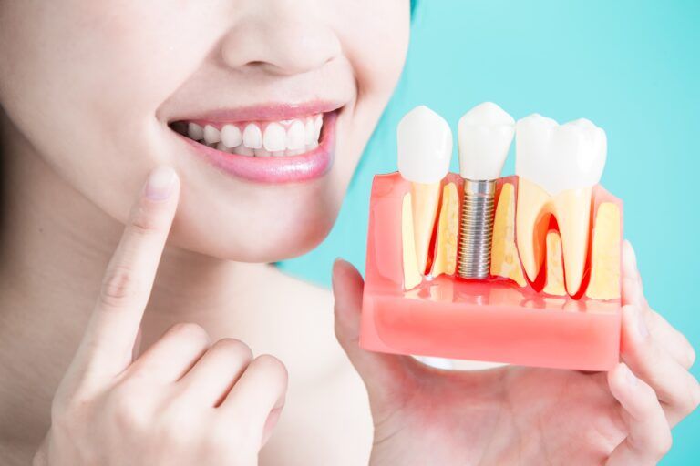 woman pointing to her mouth and holding a model of dental implants
