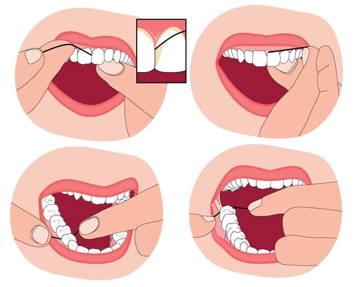 four images showing how to properly floss your teeth