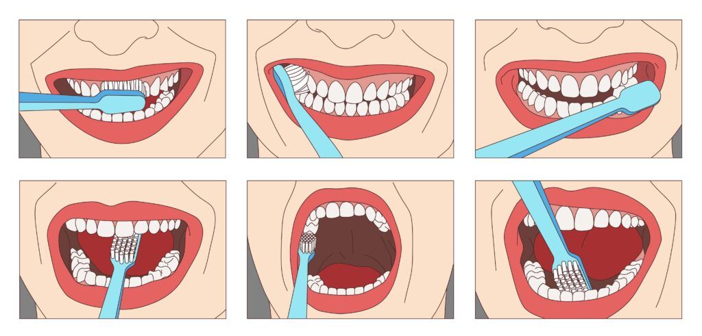 six images showing a step by step progression on how to properly brush your teeth