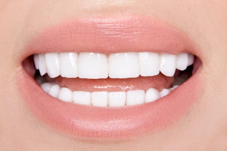close up of a white smile