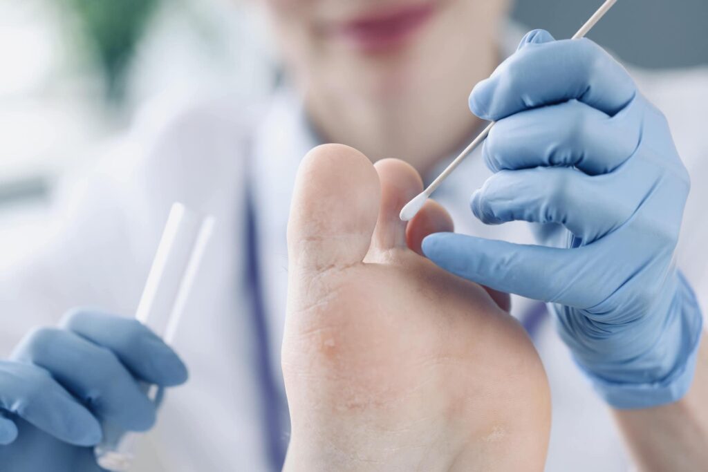 Doctor treating patients toes in clinic closeup. Nail fungus treatment concept