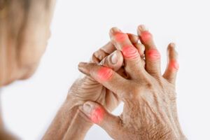 Early Detection Screening and Early Signs of Rheumatoid Arthritis.jpg