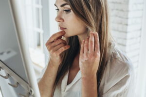 Psoriasis. Acute psoriasis on the knees, body, elbows is an autoimmune,