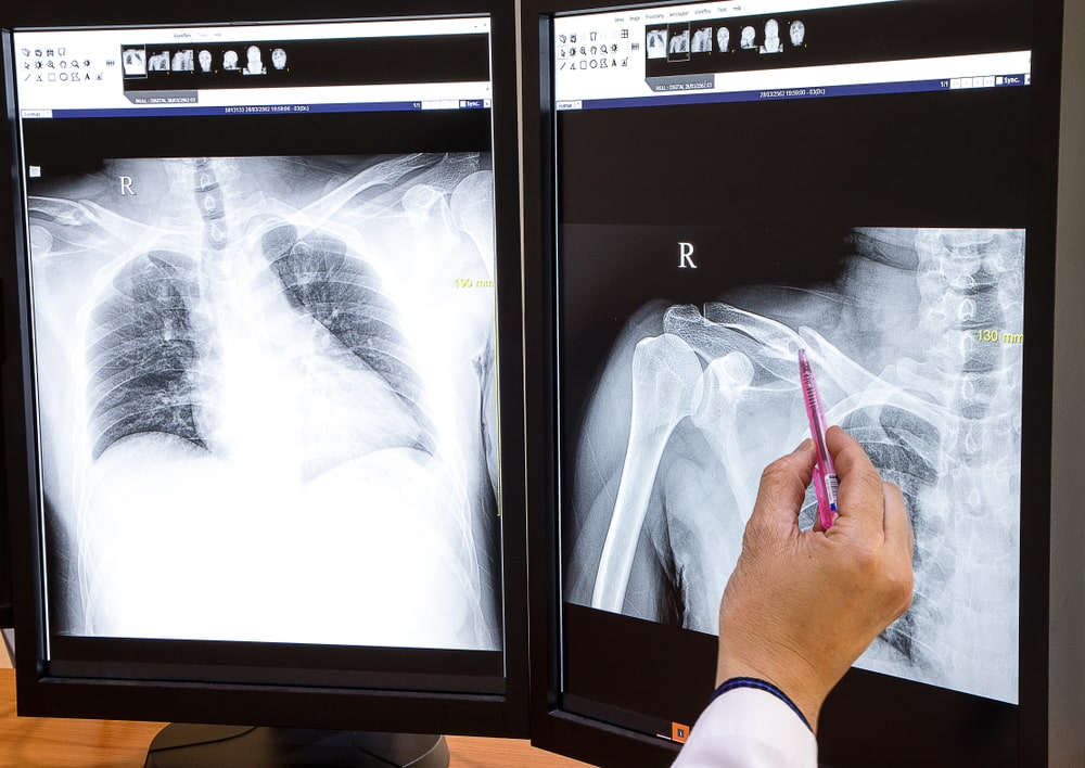 A medical doctor checking at xray images on a large double screen computer workstation