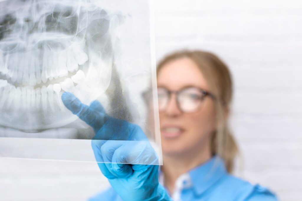 Close-up of a blonde woman doctor looks at a panoramic x-ray