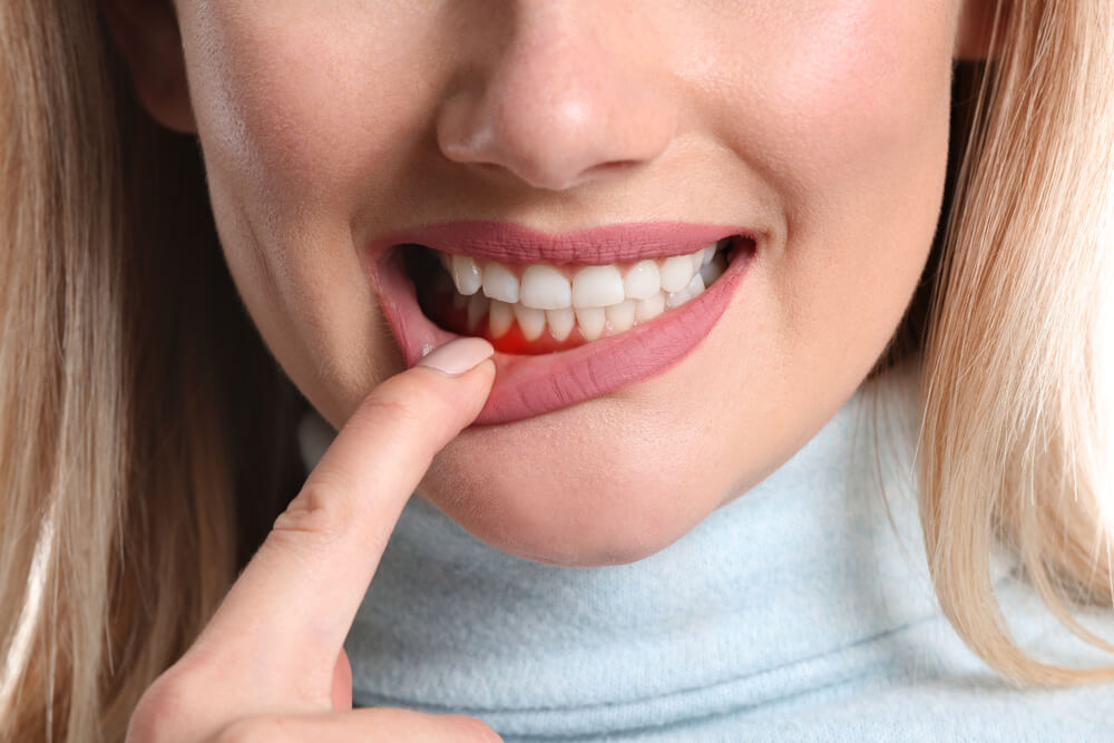 Woman with gum inflammation, closeup