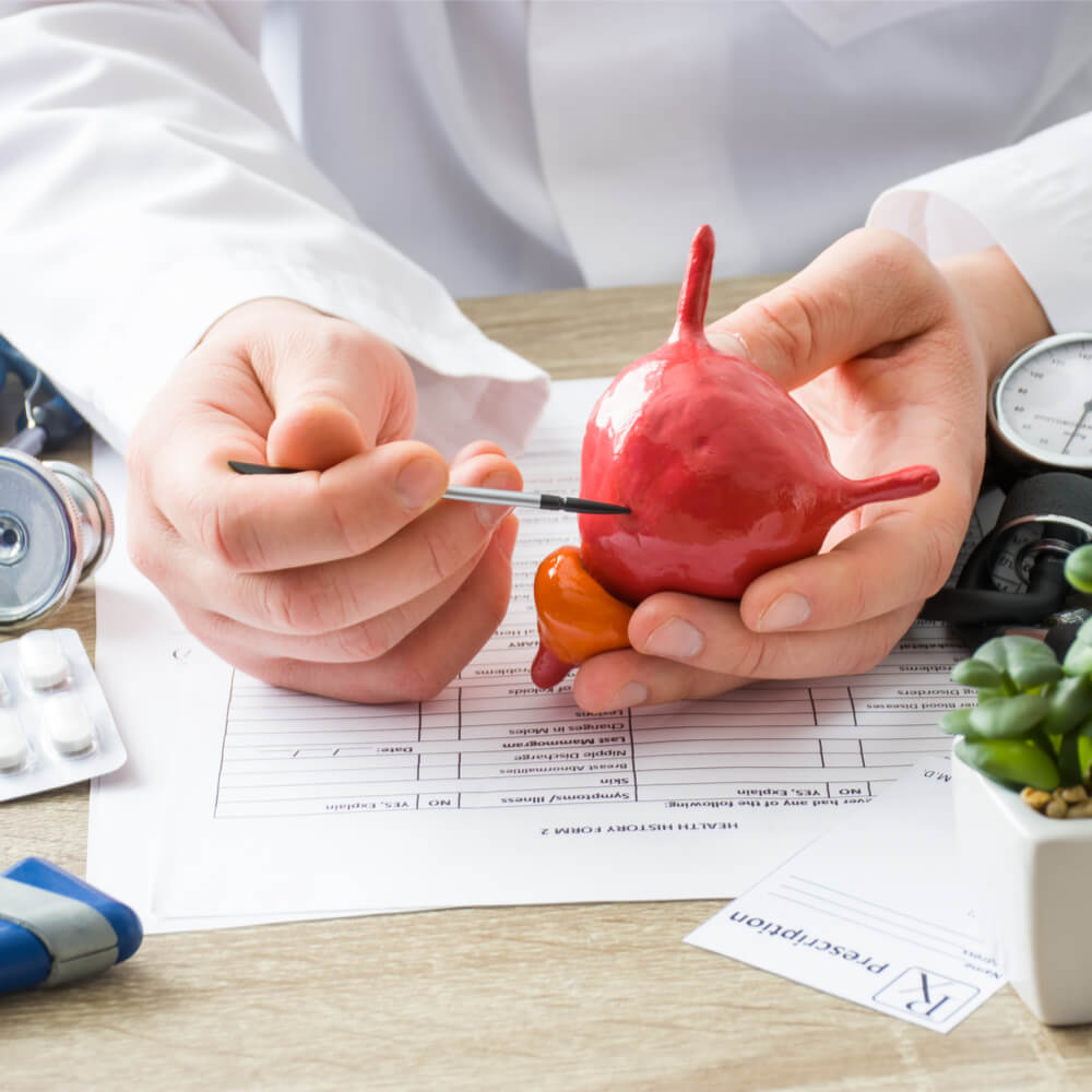 At doctors appointment physician shows to patient shape of urine bladder