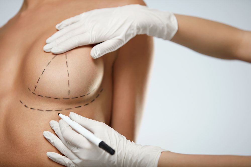The Benefits Of Combining Breast Augmentation And Breast Lift