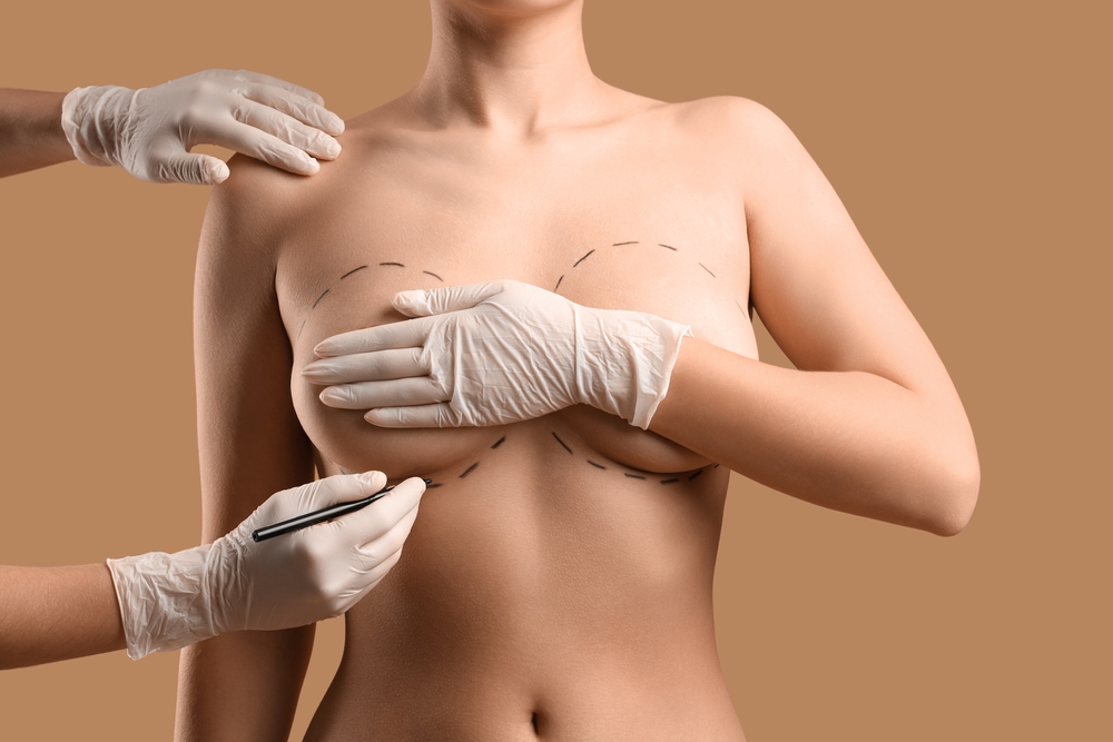 Surgical Options for Uneven Breasts