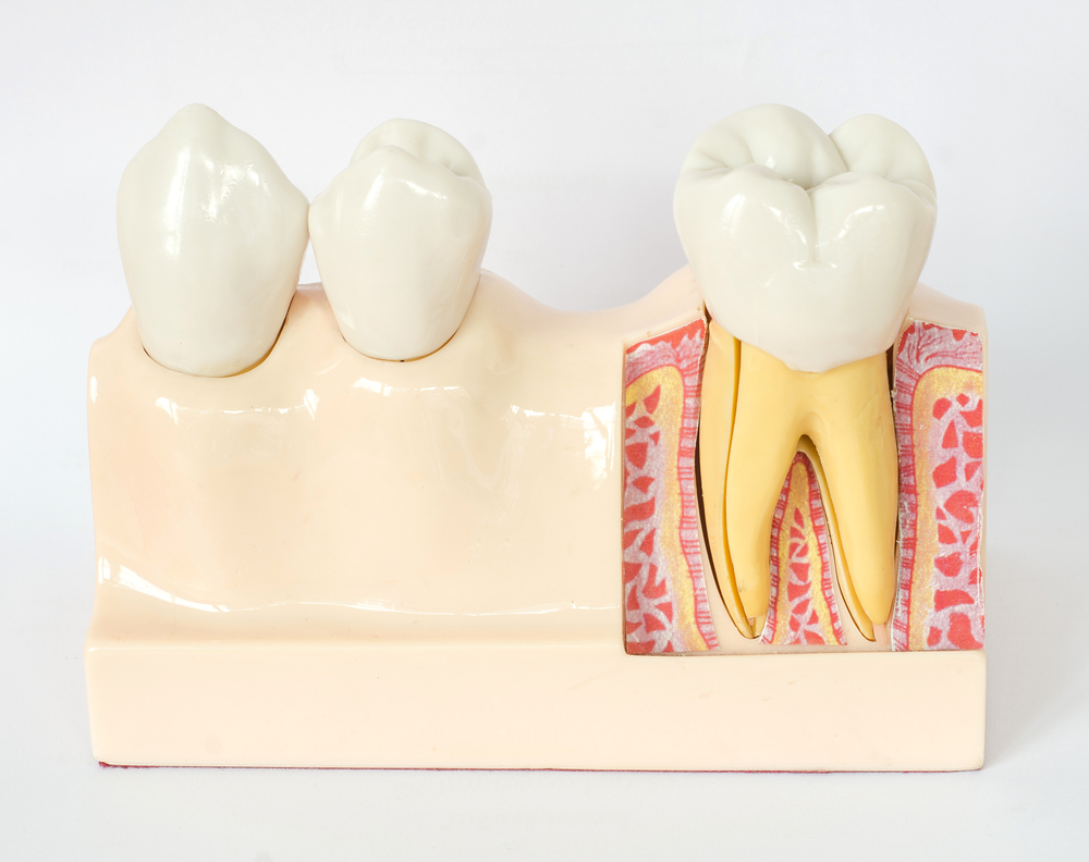 Dental Model