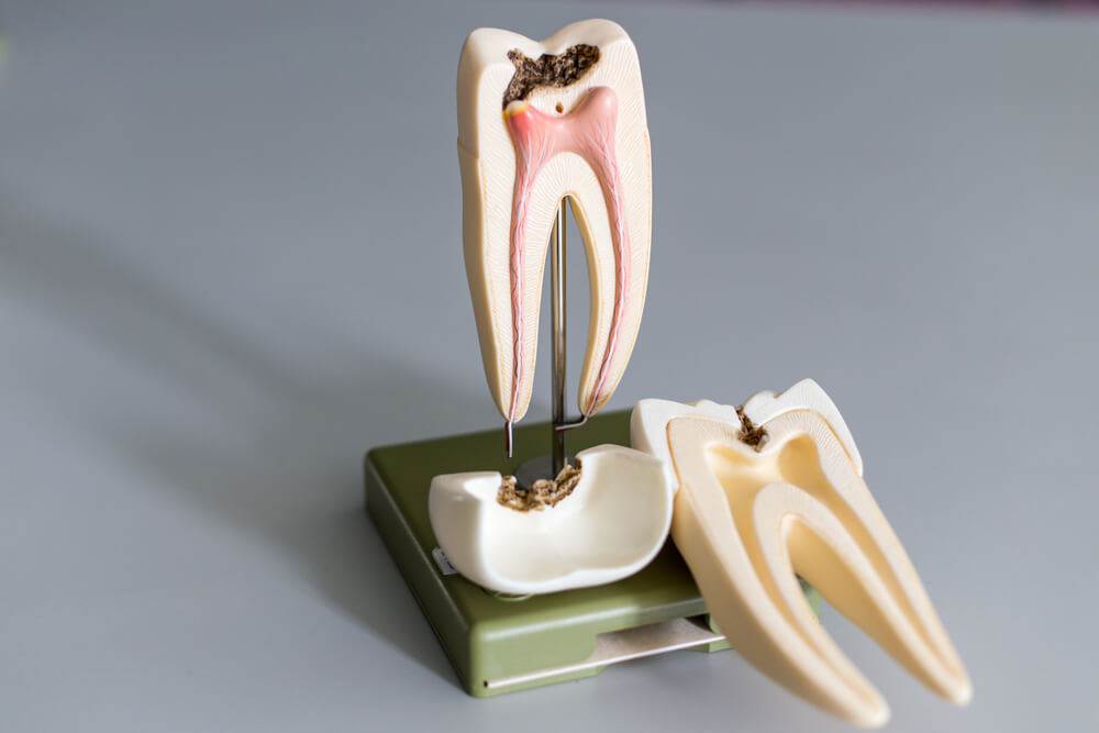 Tooth model for education in laboratory.