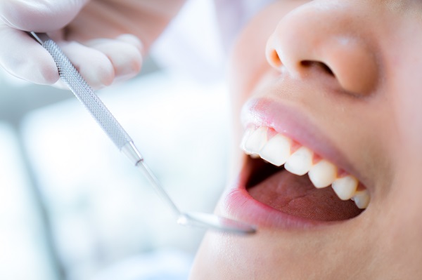 Close-up,Of,Young,Female,Having,Her,Teeth,Examinated