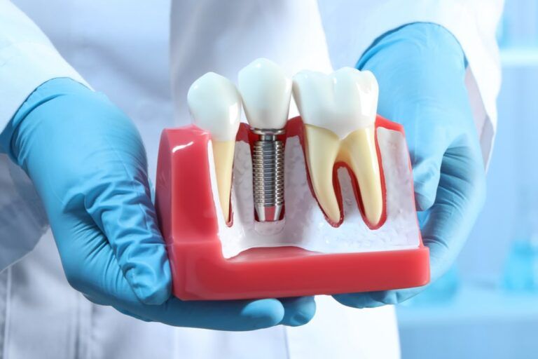 Dentist holding educational model of gum with dental implant