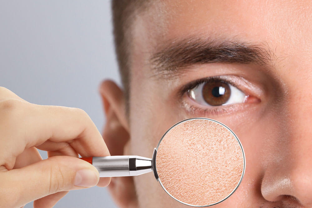 Man with dry skin visiting dermatologist, closeup