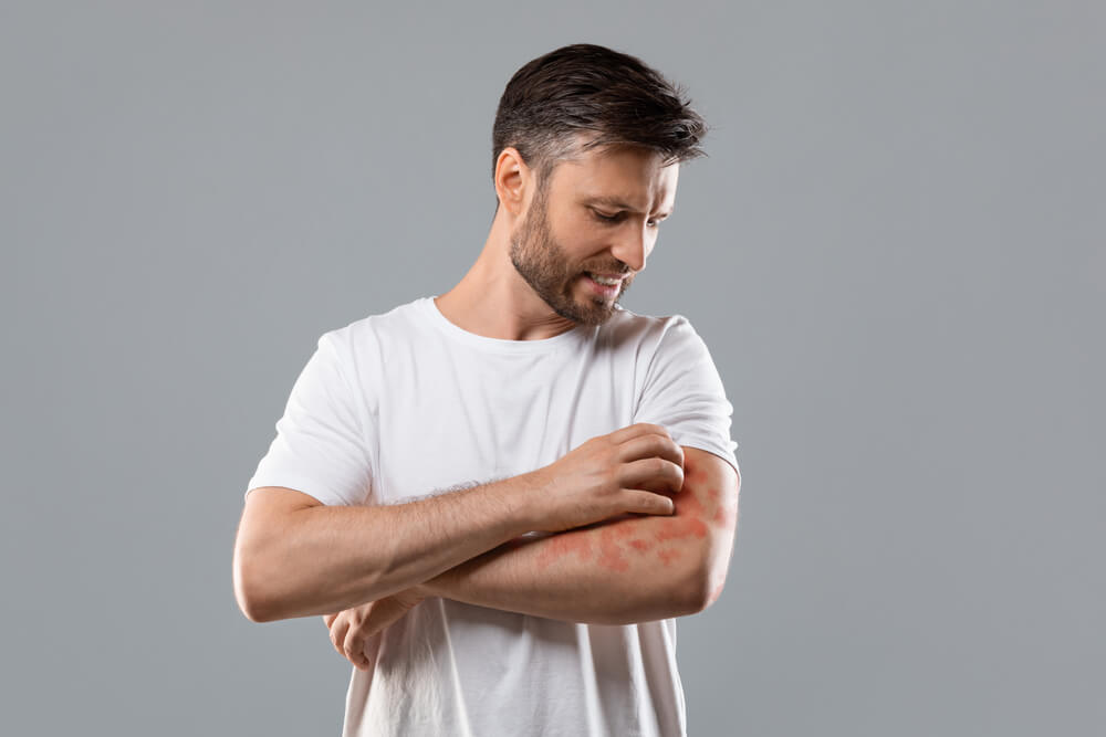 Annoyed middle-aged man in white t-shirt scratching itch on his arm