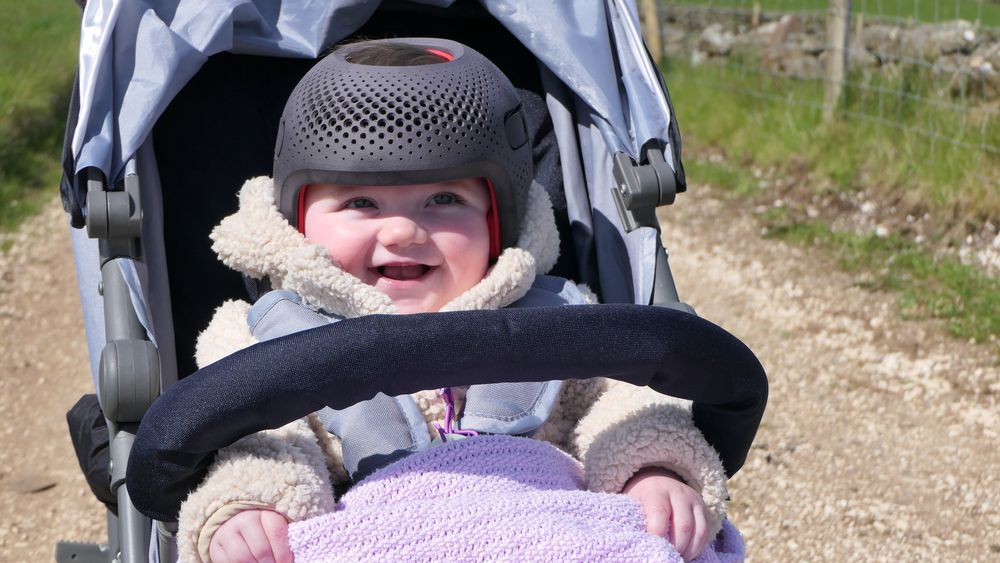 Does My Child Have Plagiocephaly