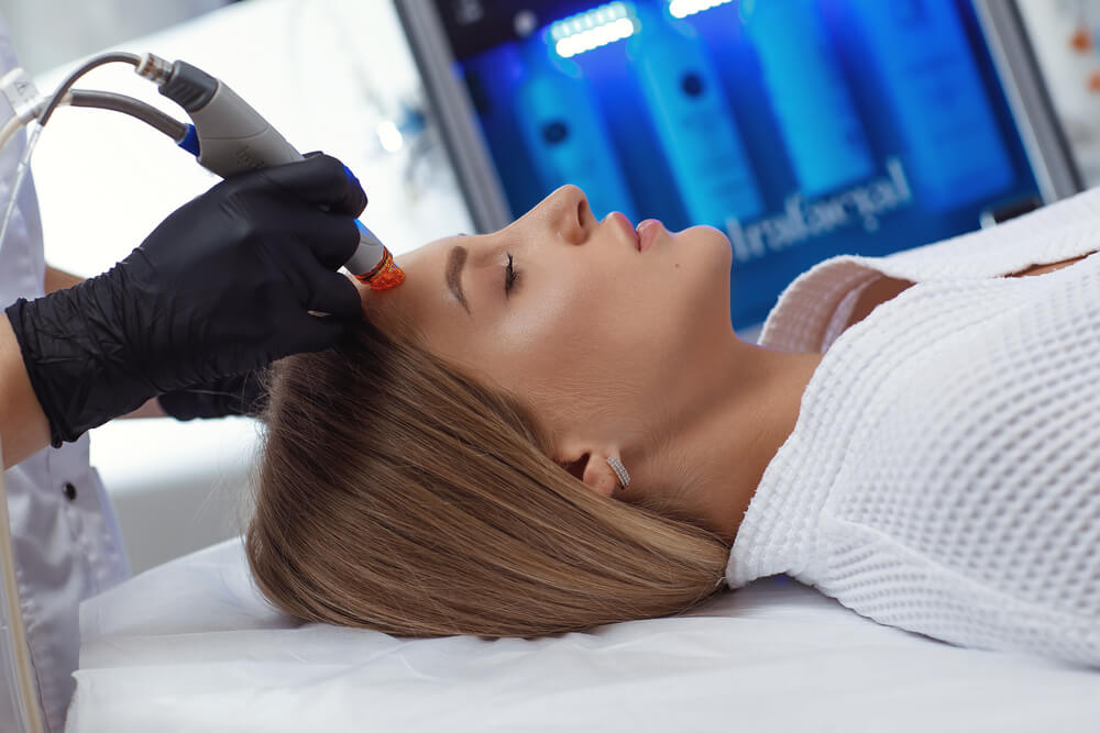 Side view of woman receiving microdermabrasion therapy on forehead at beauty spa