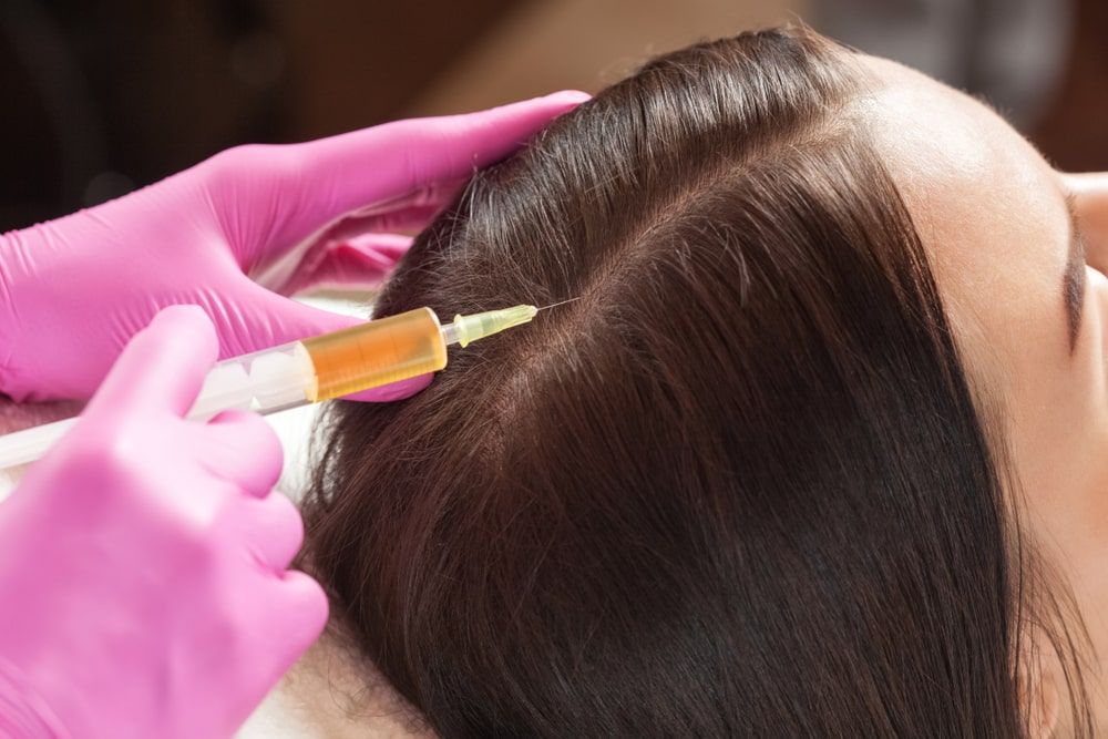 Cosmetologist does prp therapy against hair loss of a beautiful woman