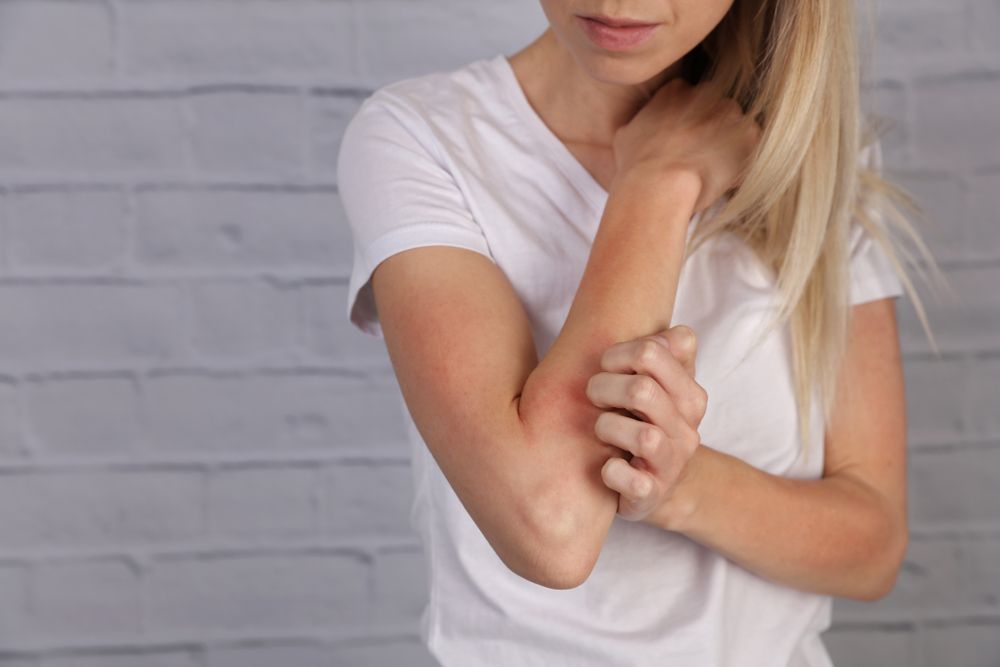 Eczema vs. Psoriasis Which Is Which?