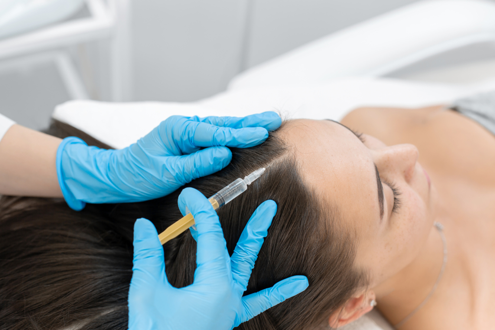 PRP for Hair Loss