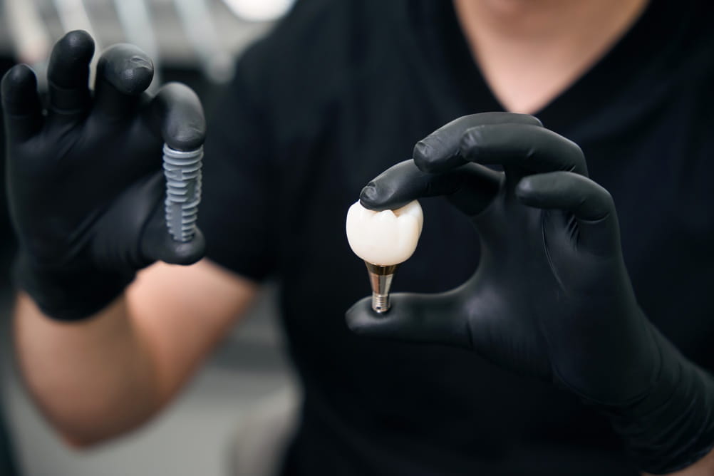 Person holding dental implant and crown in dental clinic