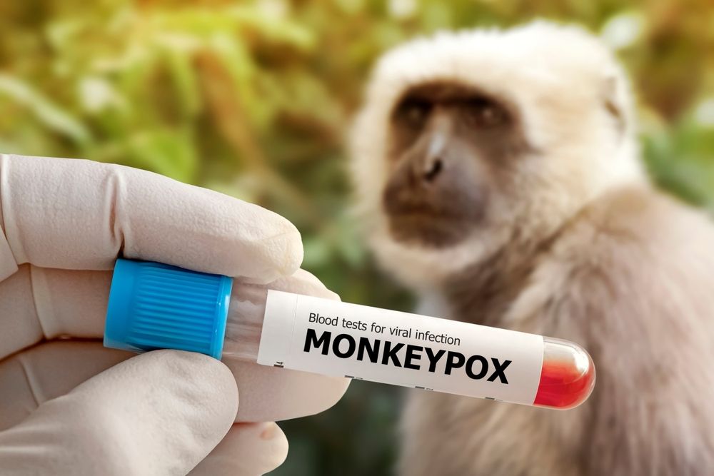 Medical,Worker,Holds,A,Test,Tube,With,Monkeypox,Virus,Infected