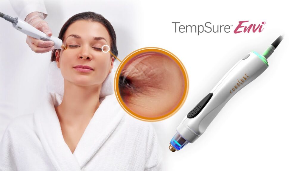 tempsure envi treatment device