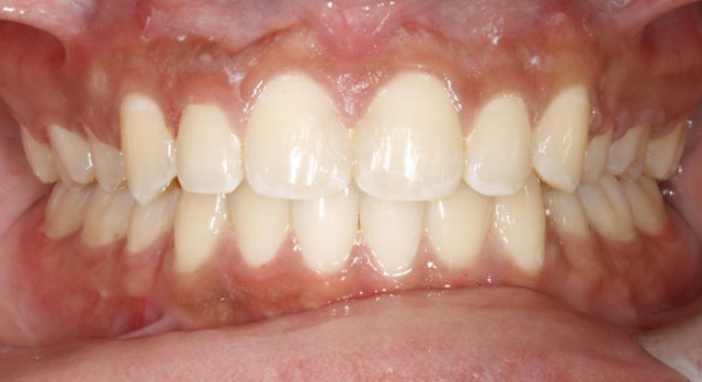 Orthodontic Case after