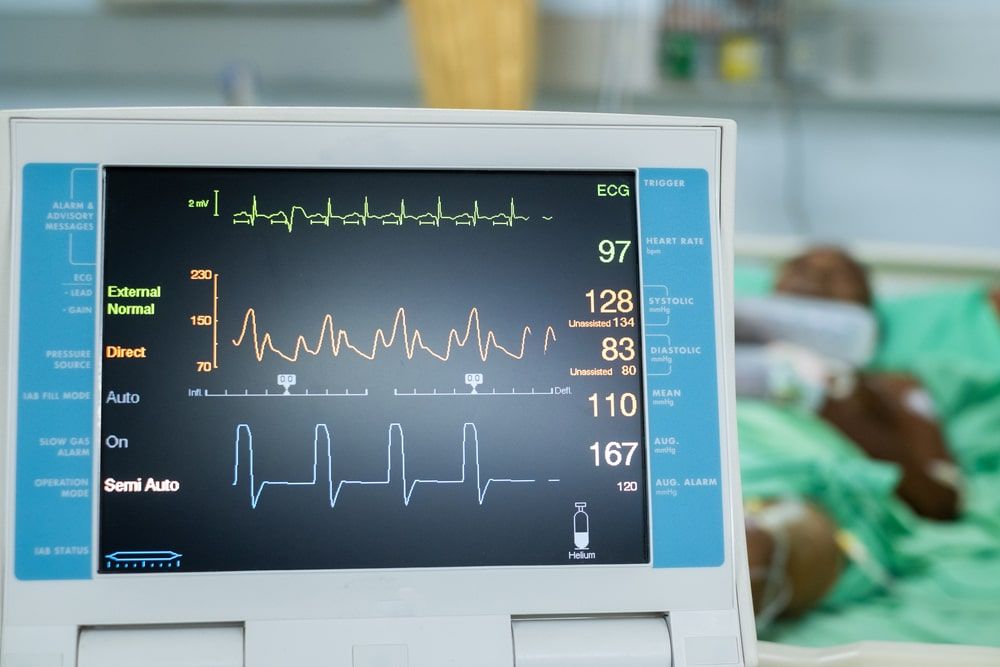 EKG monitor in intra aortic balloon pump machine