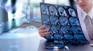 Young Female Doctor Holding Mri Or Ct Scan Picture Doctor