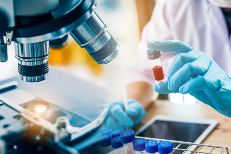 Lab Technician Assistant Analyzing A Blood Sample In Test Tube