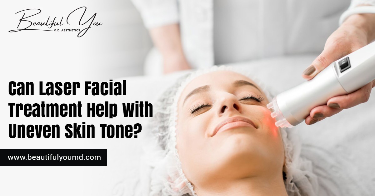 Can Laser Facial Treatment Help With Uneven Skin Tone