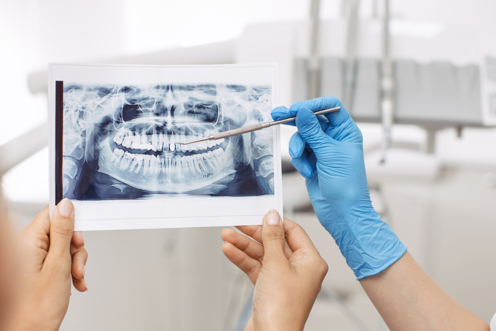 Dentist showing X-ray image to patient