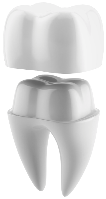 Dental Implant