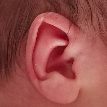 pointed ear cartilage