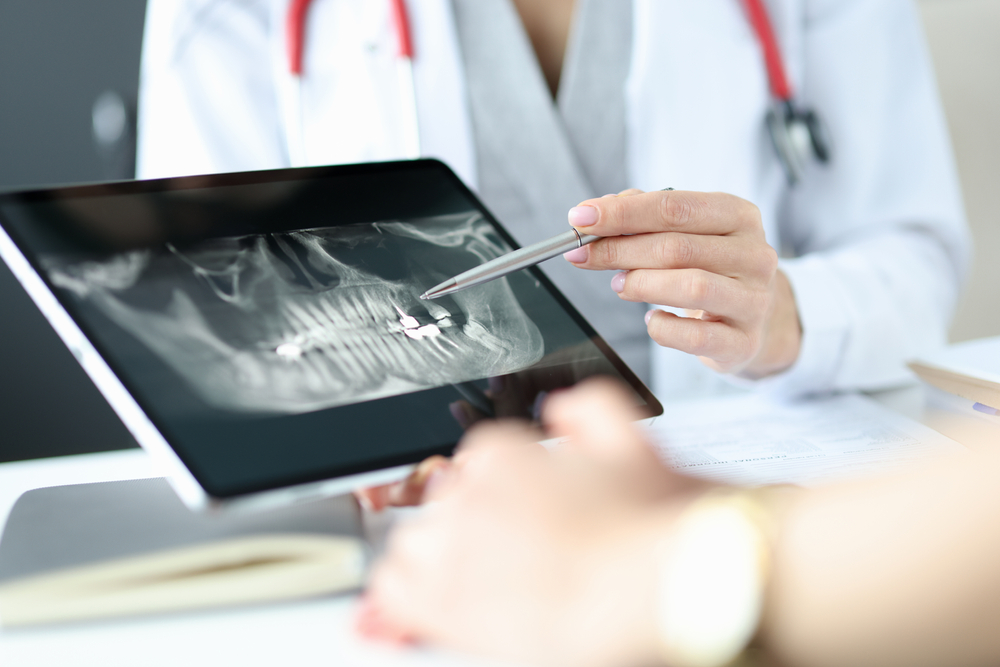 Dentist Shows An X-ray