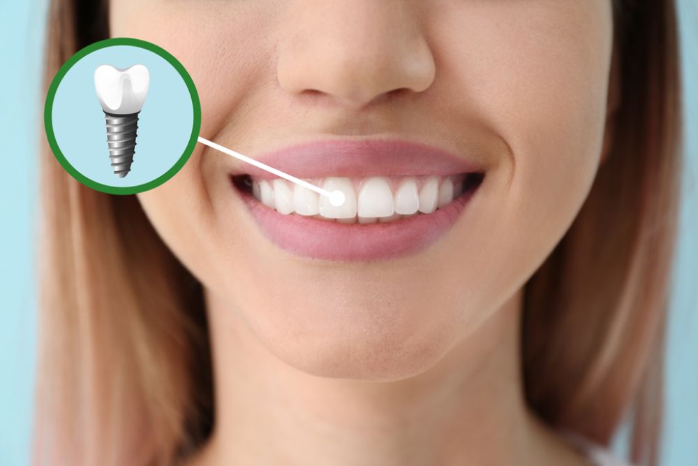 Young woman with implanted teeth, closeup