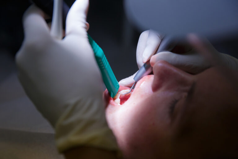 Patient at dentists office, getting soft-tissue probed and teeth cleaned of tartar and plaque