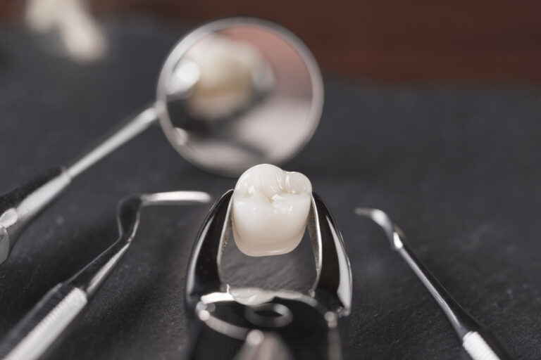 Tooth extraction concept with an array of stainless steel dental tools