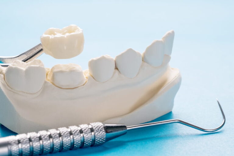 Closeup / Prosthodontics or Prosthetic / Single teeth crown and bridge equipment model express fix restoration.