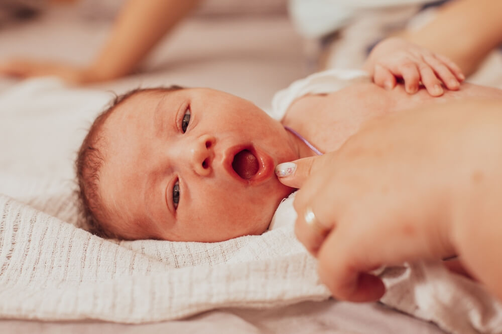 The examination of newborn baby mouth