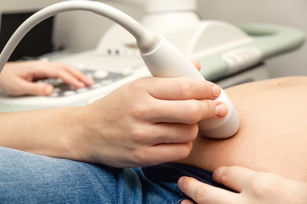 The hands of a doctor in close-up doing ultrasound to a pregnant woman