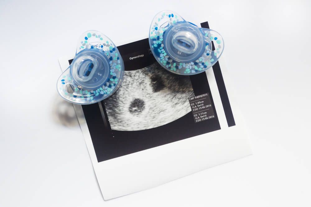 Twin pregnancy ultrasound.